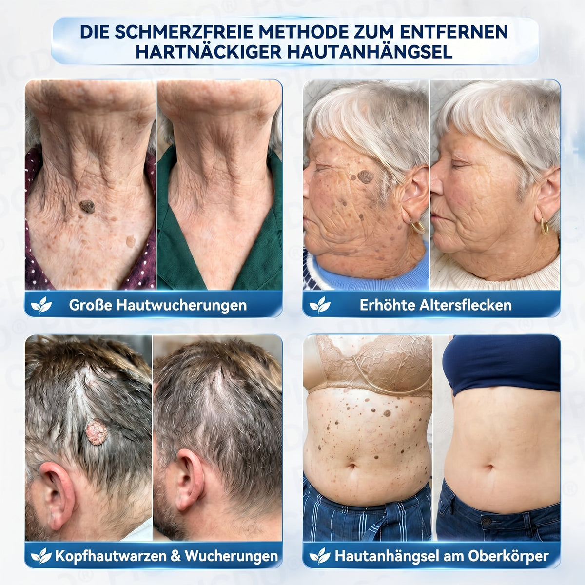 ✨✨𝐏𝐢𝐜𝐝𝐨® 𝑪𝒓𝒆𝒎𝒆 𝑮𝒆𝒈𝒆𝒏 𝑯𝒂𝒖𝒕𝒂𝒏𝒉ä𝒏𝒈𝒔𝒆𝒍 & 𝑷𝒊𝒈𝒎𝒆𝒏𝒕𝒇𝒍𝒆𝒄𝒌𝒆𝒏 7 𝑻𝒂𝒈𝒆🩵 (𝐹𝑜𝑟𝑚𝑒𝑙 𝑜ℎ𝑛𝑒 𝑆𝑐ℎ𝑚𝑒𝑟𝑧𝑒𝑛 𝑢𝑛𝑑 𝑜ℎ𝑛𝑒 𝑁𝑎𝑟𝑏𝑒𝑛) 💪