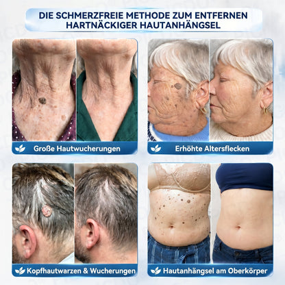 ✨✨𝐏𝐢𝐜𝐝𝐨® 𝑪𝒓𝒆𝒎𝒆 𝑮𝒆𝒈𝒆𝒏 𝑯𝒂𝒖𝒕𝒂𝒏𝒉ä𝒏𝒈𝒔𝒆𝒍 & 𝑷𝒊𝒈𝒎𝒆𝒏𝒕𝒇𝒍𝒆𝒄𝒌𝒆𝒏 7 𝑻𝒂𝒈𝒆🩵 (𝐹𝑜𝑟𝑚𝑒𝑙 𝑜ℎ𝑛𝑒 𝑆𝑐ℎ𝑚𝑒𝑟𝑧𝑒𝑛 𝑢𝑛𝑑 𝑜ℎ𝑛𝑒 𝑁𝑎𝑟𝑏𝑒𝑛) 💪