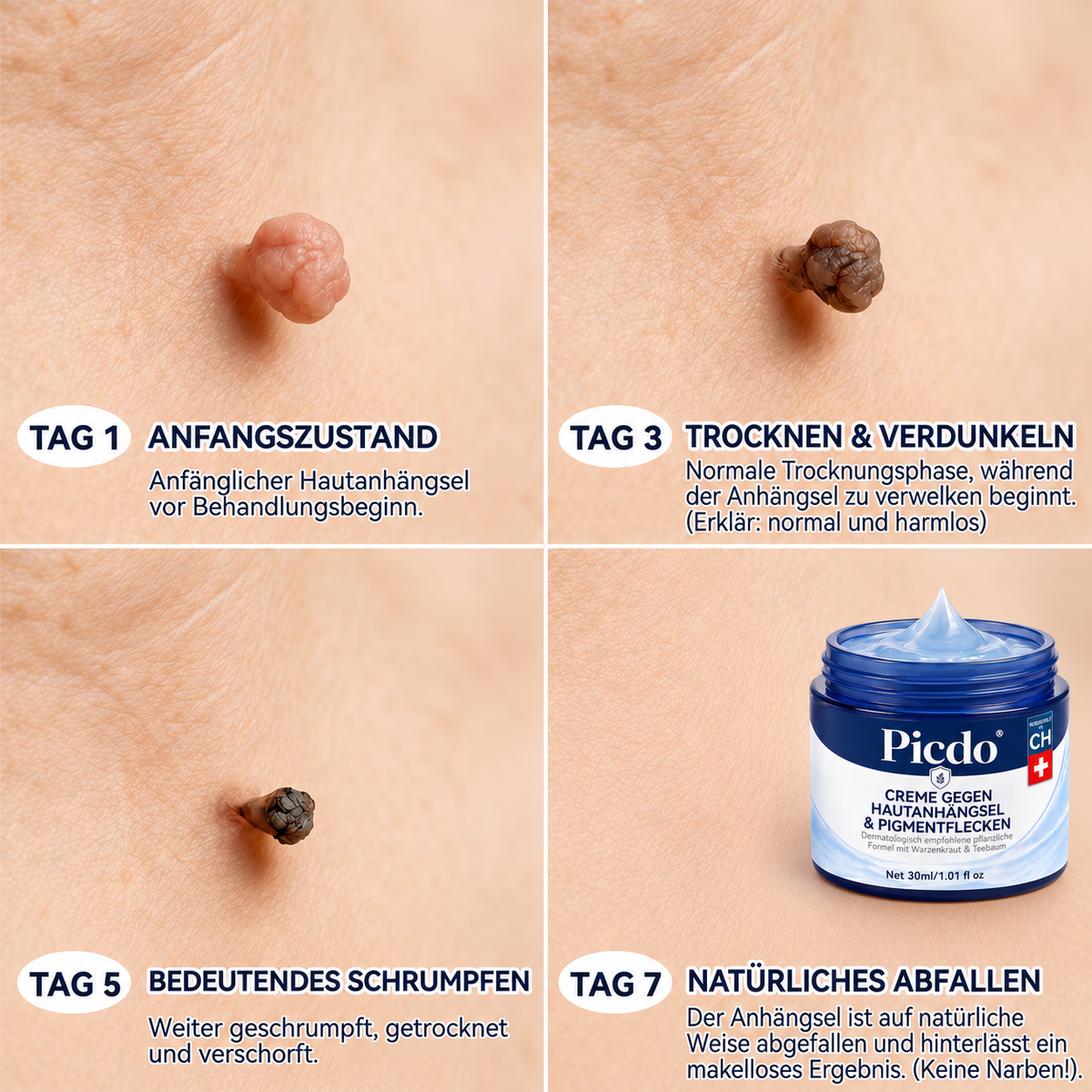 ✨✨𝐏𝐢𝐜𝐝𝐨® 𝑪𝒓𝒆𝒎𝒆 𝑮𝒆𝒈𝒆𝒏 𝑯𝒂𝒖𝒕𝒂𝒏𝒉ä𝒏𝒈𝒔𝒆𝒍 & 𝑷𝒊𝒈𝒎𝒆𝒏𝒕𝒇𝒍𝒆𝒄𝒌𝒆𝒏 7 𝑻𝒂𝒈𝒆🩵 (𝐹𝑜𝑟𝑚𝑒𝑙 𝑜ℎ𝑛𝑒 𝑆𝑐ℎ𝑚𝑒𝑟𝑧𝑒𝑛 𝑢𝑛𝑑 𝑜ℎ𝑛𝑒 𝑁𝑎𝑟𝑏𝑒𝑛) 💪