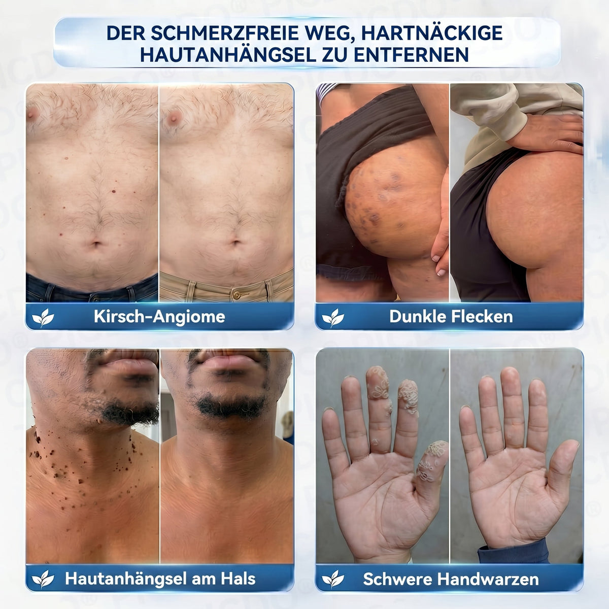 ✨✨𝐏𝐢𝐜𝐝𝐨® 𝑪𝒓𝒆𝒎𝒆 𝑮𝒆𝒈𝒆𝒏 𝑯𝒂𝒖𝒕𝒂𝒏𝒉ä𝒏𝒈𝒔𝒆𝒍 & 𝑷𝒊𝒈𝒎𝒆𝒏𝒕𝒇𝒍𝒆𝒄𝒌𝒆𝒏 7 𝑻𝒂𝒈𝒆🩵 (𝐹𝑜𝑟𝑚𝑒𝑙 𝑜ℎ𝑛𝑒 𝑆𝑐ℎ𝑚𝑒𝑟𝑧𝑒𝑛 𝑢𝑛𝑑 𝑜ℎ𝑛𝑒 𝑁𝑎𝑟𝑏𝑒𝑛) 💪